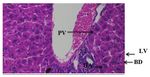 Histopathological Changes in Liver Induced by Piroxicam Administration in Adult Male Albino Mice Mus musculus