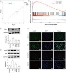 Exogenous sodium hydrosulfide protects against high glucose induced injury and inflammation in human umbilical vein endothelial cells by ...