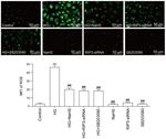 Exogenous sodium hydrosulfide protects against high glucose induced injury and inflammation in human umbilical vein endothelial cells by ...