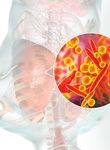Preventing hospital-acquired pneumonia - Implementing a fundamental nursing skills bundle can reduce risk - American Nurse ...