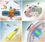 Implantable Pulse Generators for Deep Brain Stimulation: Challenges, Complications, and Strategies for Practicality and Longevity - Frontiers