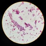 Curcumin and Hispolon as Potential Antibacterial Agents