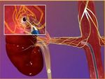Update on HTN and ABPM - Raj Padwal Division of General Internal Medicine University of Alberta