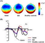 Mismatch negativity indices and functional outcomes in unipolar and bipolar depression - Nature