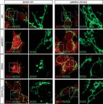 Mitochondrial redox signalling by p66Shc mediates ALS-like disease through Rac1 inactivation