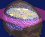 University of Florida - Department of Clinical ...
