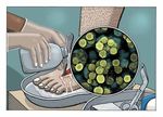 How to Treat WOUND INFECTION - Prevention and treatment Richard Everts - ACC