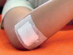 How to Treat WOUND INFECTION - Prevention and treatment Richard Everts - ACC