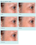 Journal of Dermatology Sciences Research Reviews & Reports