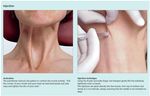 Journal of Dermatology Sciences Research Reviews & Reports