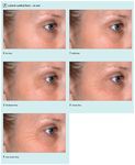 Journal of Dermatology Sciences Research Reviews & Reports