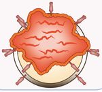 KML Experten berichten vom EHA 2018 in Stockholm