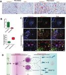 IL-6 promotes drug resistance through formation of polyploid giant cancer cells and stromal fibroblast reprogramming
