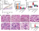 IL-6 promotes drug resistance through formation of polyploid giant cancer cells and stromal fibroblast reprogramming