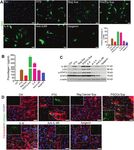 IL-6 promotes drug resistance through formation of polyploid giant cancer cells and stromal fibroblast reprogramming