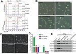 IL-6 promotes drug resistance through formation of polyploid giant cancer cells and stromal fibroblast reprogramming