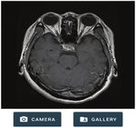 Medicolite-Machine Learning-Based Patient Care Model