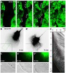 The keratin-filament cycle of assembly and disassembly