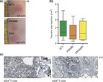 Enhancing Dendritic Cell Vaccination by Immune Checkpoint Blockade as Therapy in AML