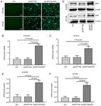 XPD inhibits cell growth and invasion and enhances chemosensitivity in esophageal squamous cell carcinoma by regulating the PI3K/AKT signaling pathway