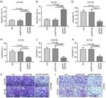 XPD inhibits cell growth and invasion and enhances chemosensitivity in esophageal squamous cell carcinoma by regulating the PI3K/AKT signaling pathway