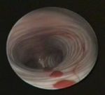 Lung hemorrhage in a green iguana (Iguana iguana) with chronic metabolic failure: a case report