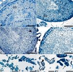 Olanzapine induced reproductive toxicity in male rats - Nature