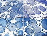 Olanzapine induced reproductive toxicity in male rats - Nature