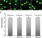 Olanzapine induced reproductive toxicity in male rats - Nature