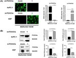 Metformin induced ROS upregulation as amplified by apigenin causes profound anticancer activity while sparing normal cells - Nature