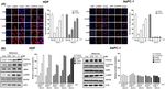 Metformin induced ROS upregulation as amplified by apigenin causes profound anticancer activity while sparing normal cells - Nature