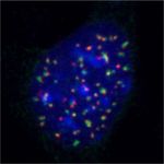 The end protection problem-an unexpected twist in the tail