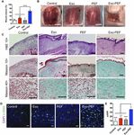 Mesenchymal stromal exosome-functionalized scaffolds induce innate and adaptive immunomodulatory responses toward tissue repair