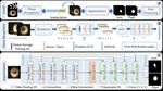 LensID: A CNN-RNN-Based Framework Towards Lens Irregularity Detection