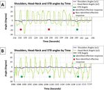 Development and piloting of a perturbation stationary bicycle robotic system that provides unexpected lateral perturbations during bicycling the ...