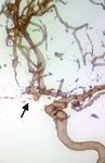 Usefulness of 3D Digital Subtraction Angiography in the Endovascular Approach of Cerebral Aneurysms