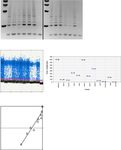 Cyst Fluid Telomerase Activity Predicts the Histologic Grade of Cystic Neoplasms of the Pancreas