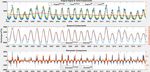 Journal of Hydrology: Regional Studies