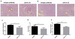 INTERLEUKIN-12 EXACERBATES SYMPTOMS IN AN MRL/MPJ-FASLPR MOUSE MODEL OF SYSTEMIC LUPUS ERYTHEMATOSUS