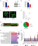 EWS splicing regulation contributes to balancing Foxp1isoforms required for neuronal differentiation