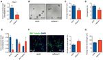 EWS splicing regulation contributes to balancing Foxp1isoforms required for neuronal differentiation