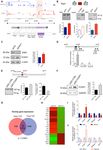 EWS splicing regulation contributes to balancing Foxp1isoforms required for neuronal differentiation