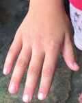 Novel Compound Heterozygous BBS2 and Homozygous MKKS Variants Detected in Chinese Families with Bardet-Biedl Syndrome - Hindawi.com