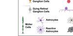 Neuroinflammation, Microglia and Implications for Retinal Ganglion Cell Survival and Axon Regeneration in Traumatic Optic Neuropathy - Frontiers
