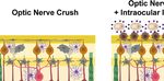 Neuroinflammation, Microglia and Implications for Retinal Ganglion Cell Survival and Axon Regeneration in Traumatic Optic Neuropathy - Frontiers