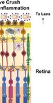 Neuroinflammation, Microglia and Implications for Retinal Ganglion Cell Survival and Axon Regeneration in Traumatic Optic Neuropathy - Frontiers