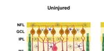 Neuroinflammation, Microglia and Implications for Retinal Ganglion Cell Survival and Axon Regeneration in Traumatic Optic Neuropathy - Frontiers