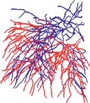 A Pulmonary Artery-Vein Separation Algorithm Based on the Relationship between Subtrees Information