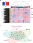 Detection of subtype-specific breast cancer surface protein biomarkers via a novel transcriptomics approach