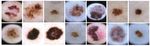 CAPSULE NEURAL NETWORKS IN CLASSIFICATION OF SKIN LESIONS